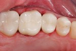 healthy-teeth